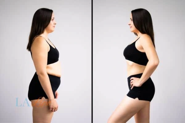 LA-EMS Body Sculpting Owsestry results before and after of womans results on body toning.