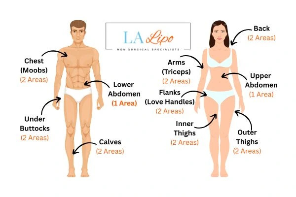 LA LIPO Cryolipolysis Areas Owsestry