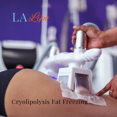 fat freezing - Cryolipolysis Owsestry