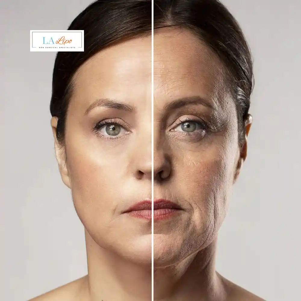 How Can You Tell If Non-Surgical Skin Tightening Is Right for You Owsestry?