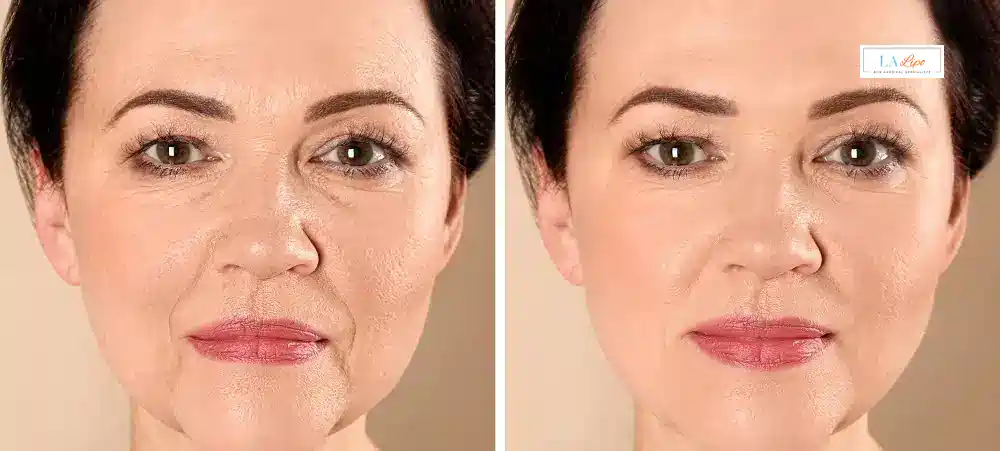 How Long Does It Take to See Results and How Long Do They Last Owsestry?